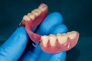Acrylic Dentures