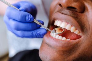 General Dentistry Procedures